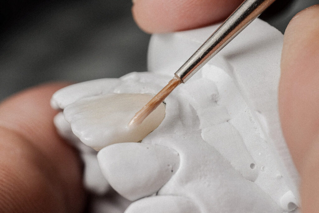 Root Canals