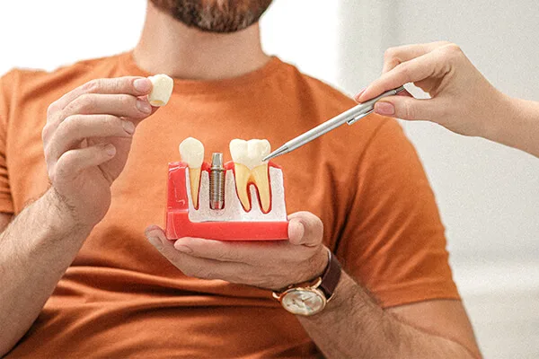 Dental Implants