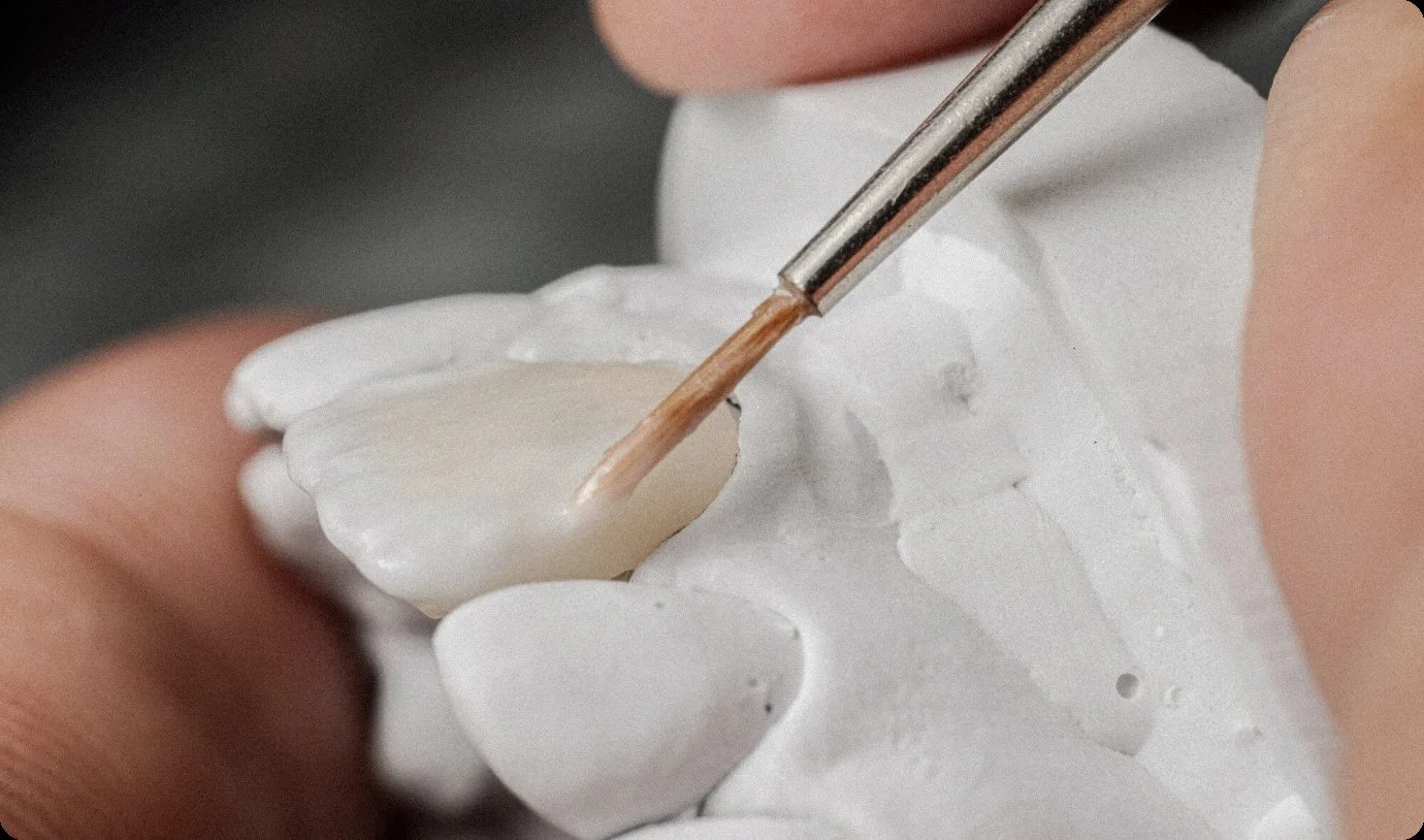 Porcelain veneer being shaped for a cosmetic smile