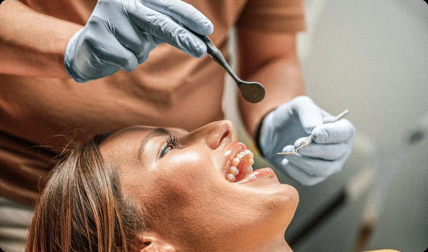Dentist placing a filling at Denteast in Fort Lauderdale